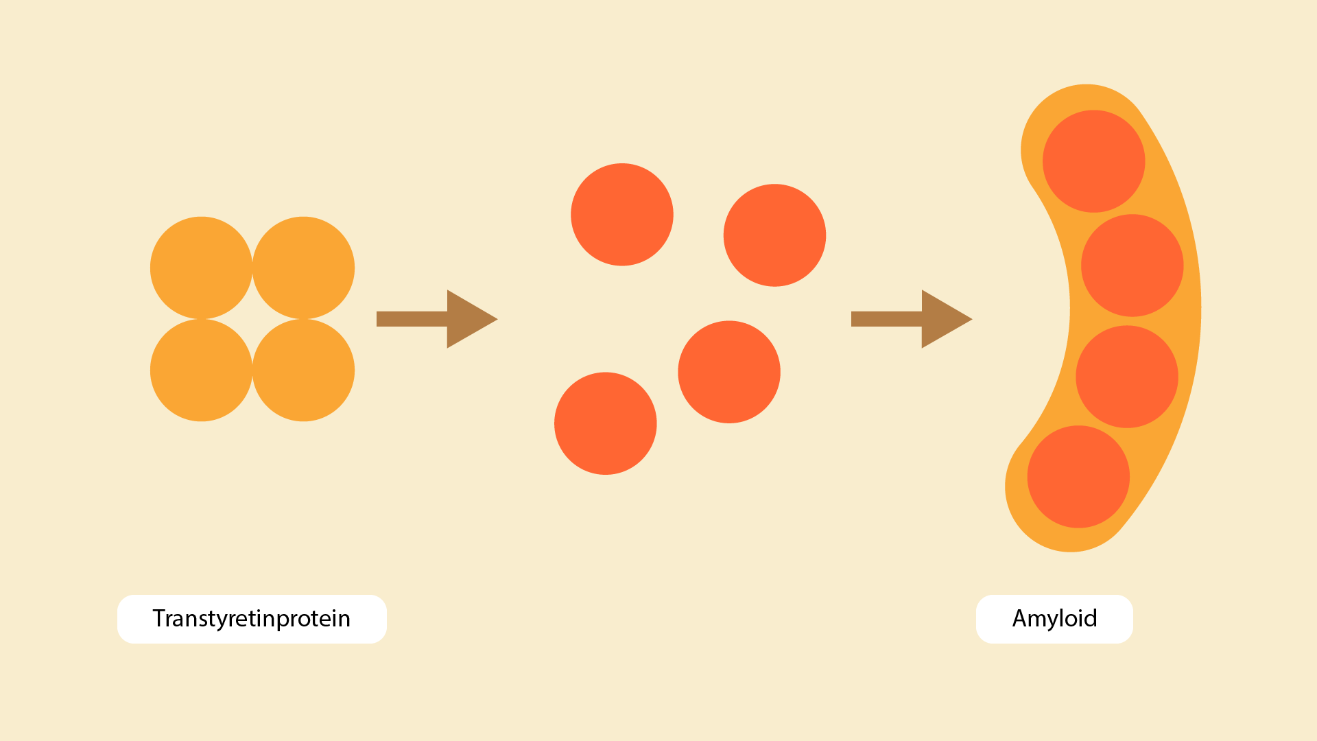 Grafisk bild som förklarar ATTR-amyloidos och dess påverkan